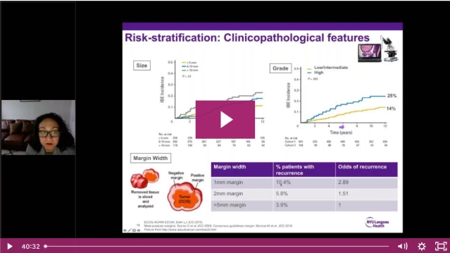 Topic-Driven Round Table on DCIS: What are Your Radiation Options?