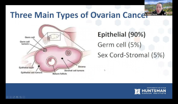 Ovarian Cancer 101